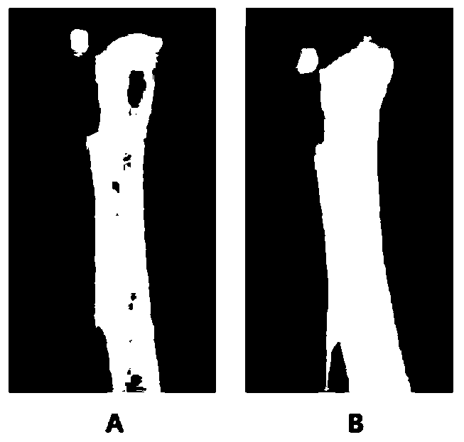 Traditional Chinese medicine composition for treating osteoporosis and preparation method thereof