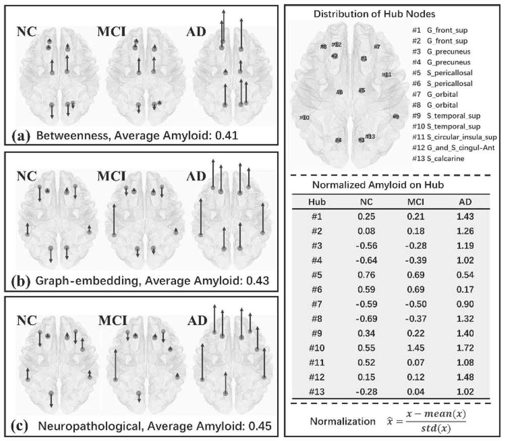 Neuropathology hub node identification method combining pathology and topological information