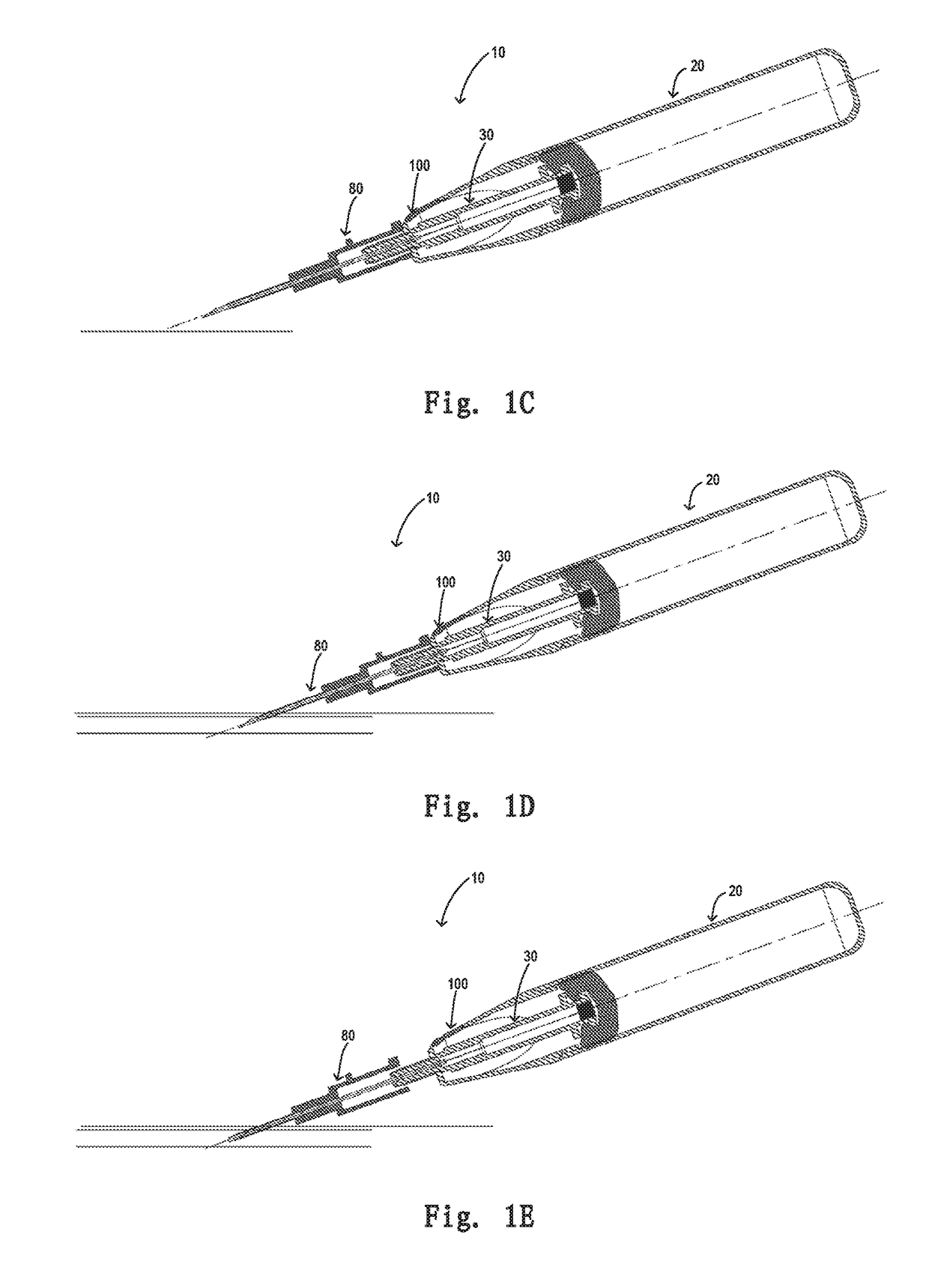 Safety mechanism for a retaining needle and a retaining needle having the safety mechanism