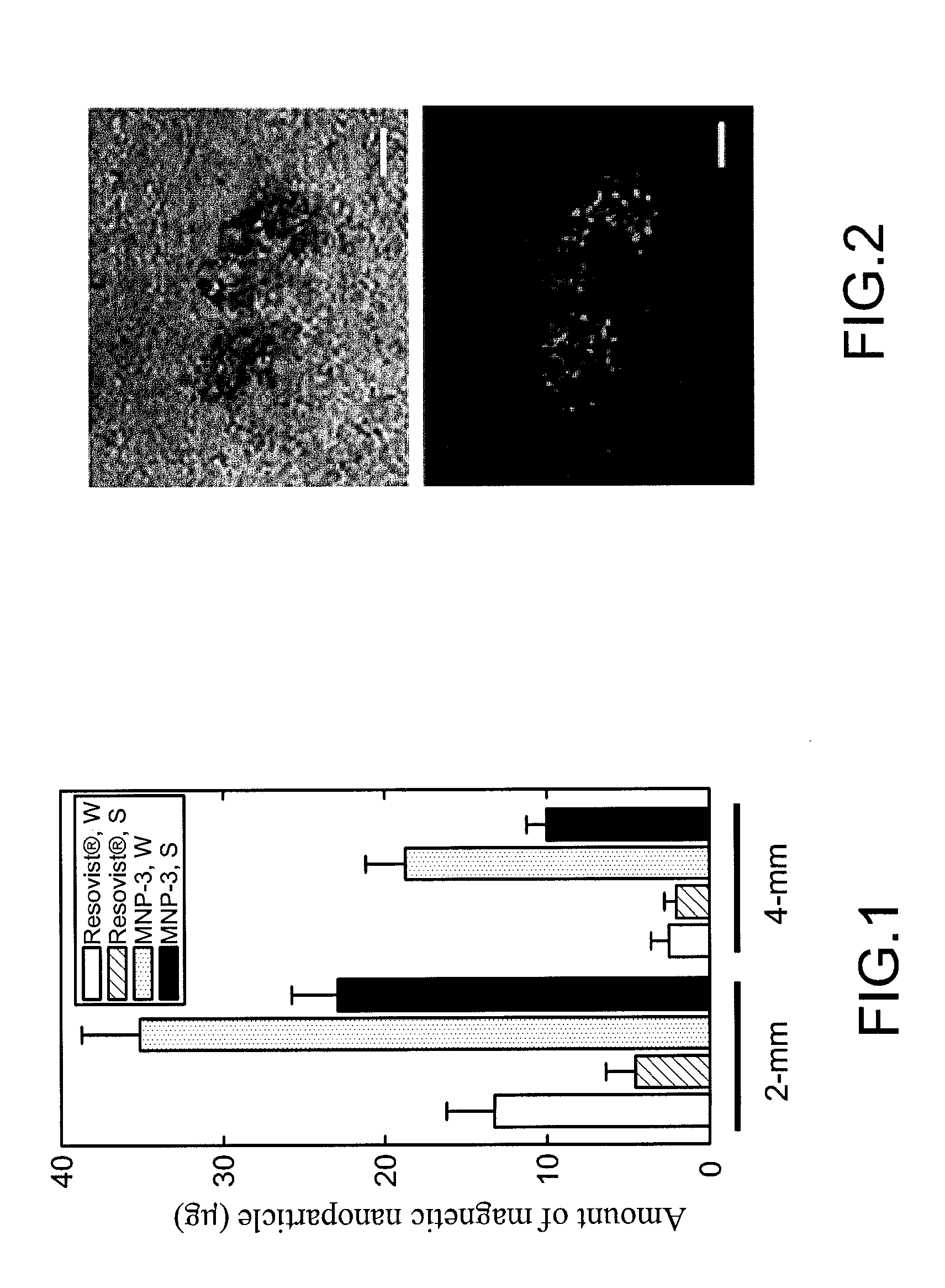 Treatment of brain diseases via ultrasound/magnetic targeting delivery and tracing of therapeutic agents