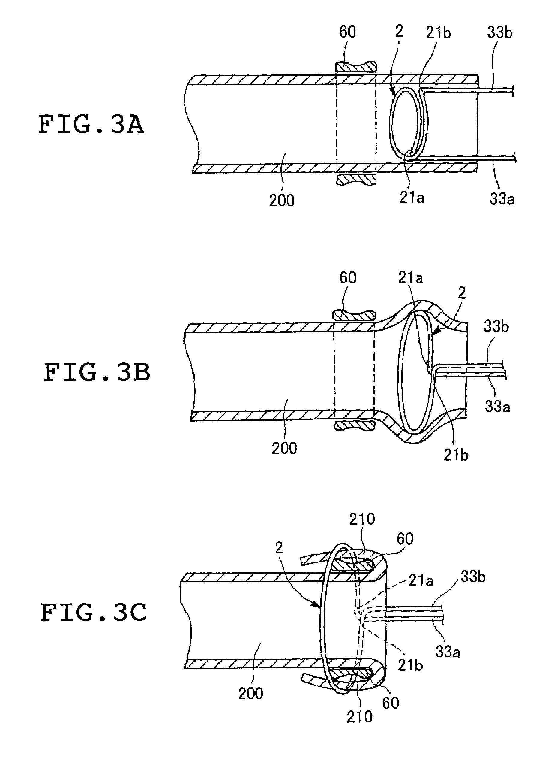 Instrument for extroverting blood vessel