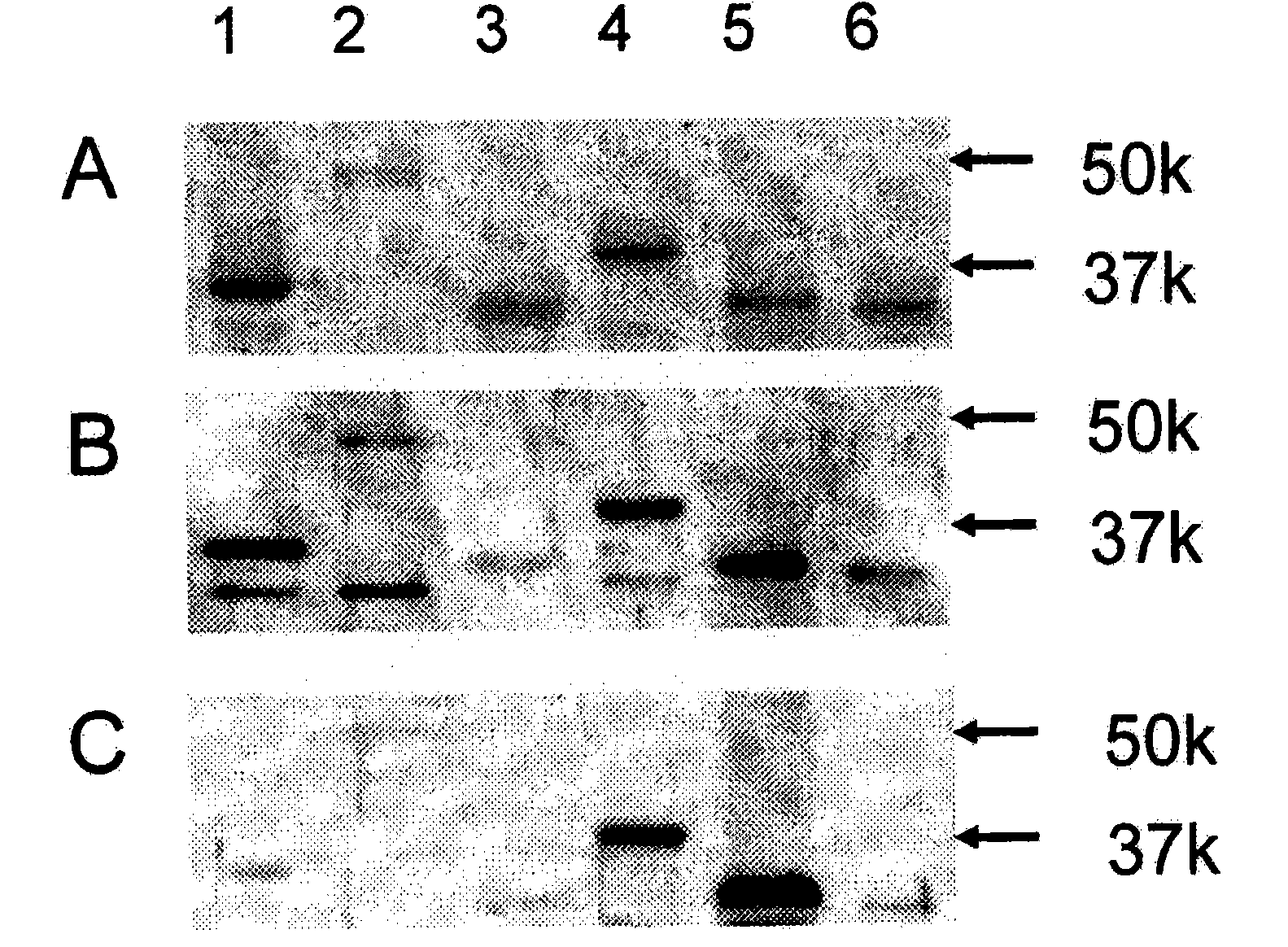 Method for detecting gynecological cancer