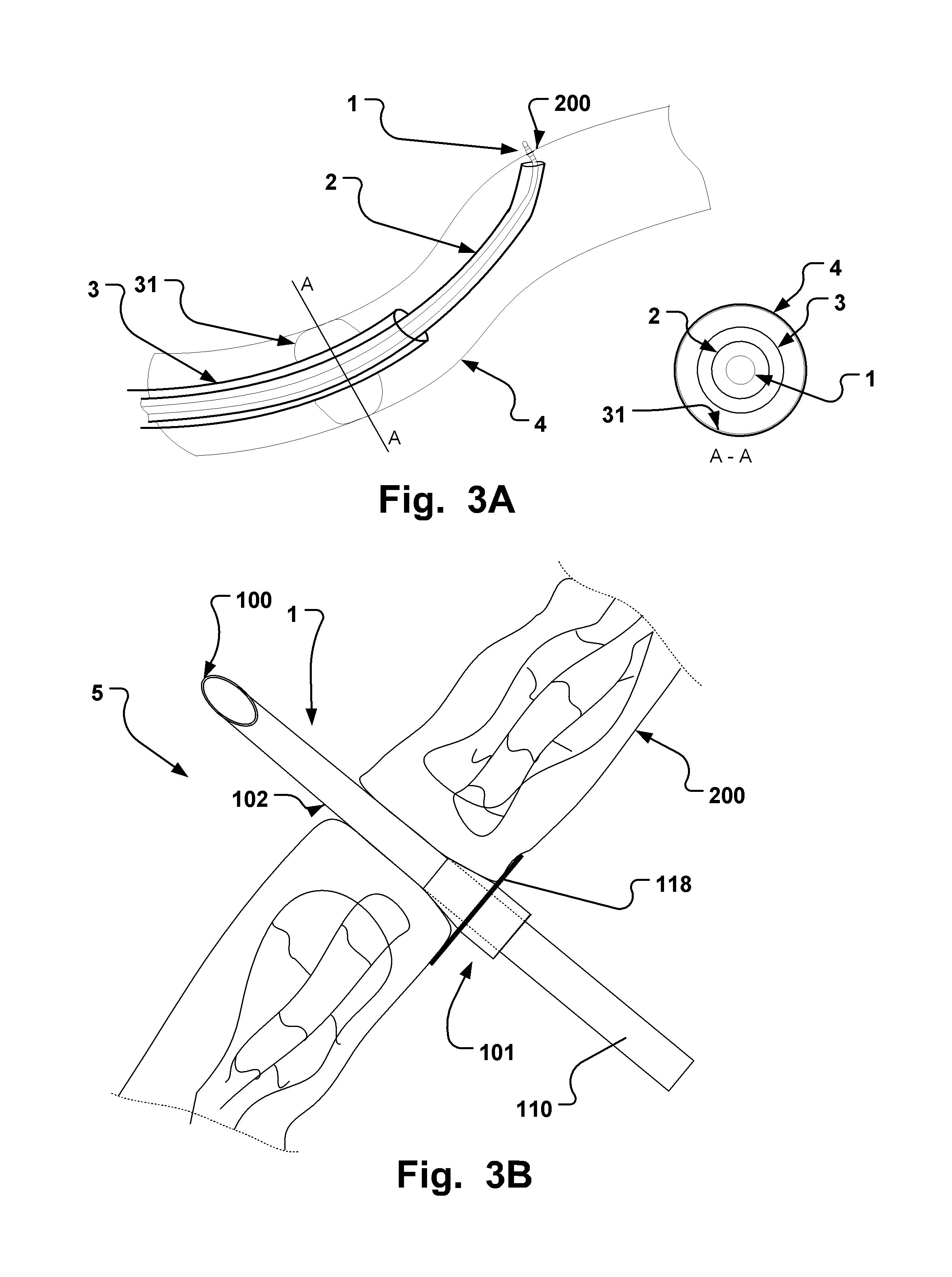 Endoluminal medical access device