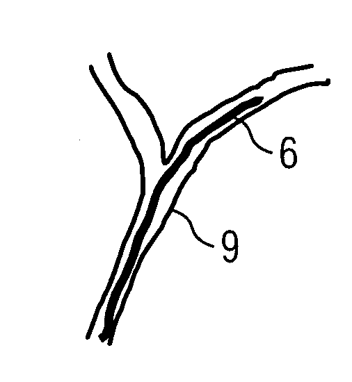 Method for determining the position of an instrument with an x-ray system