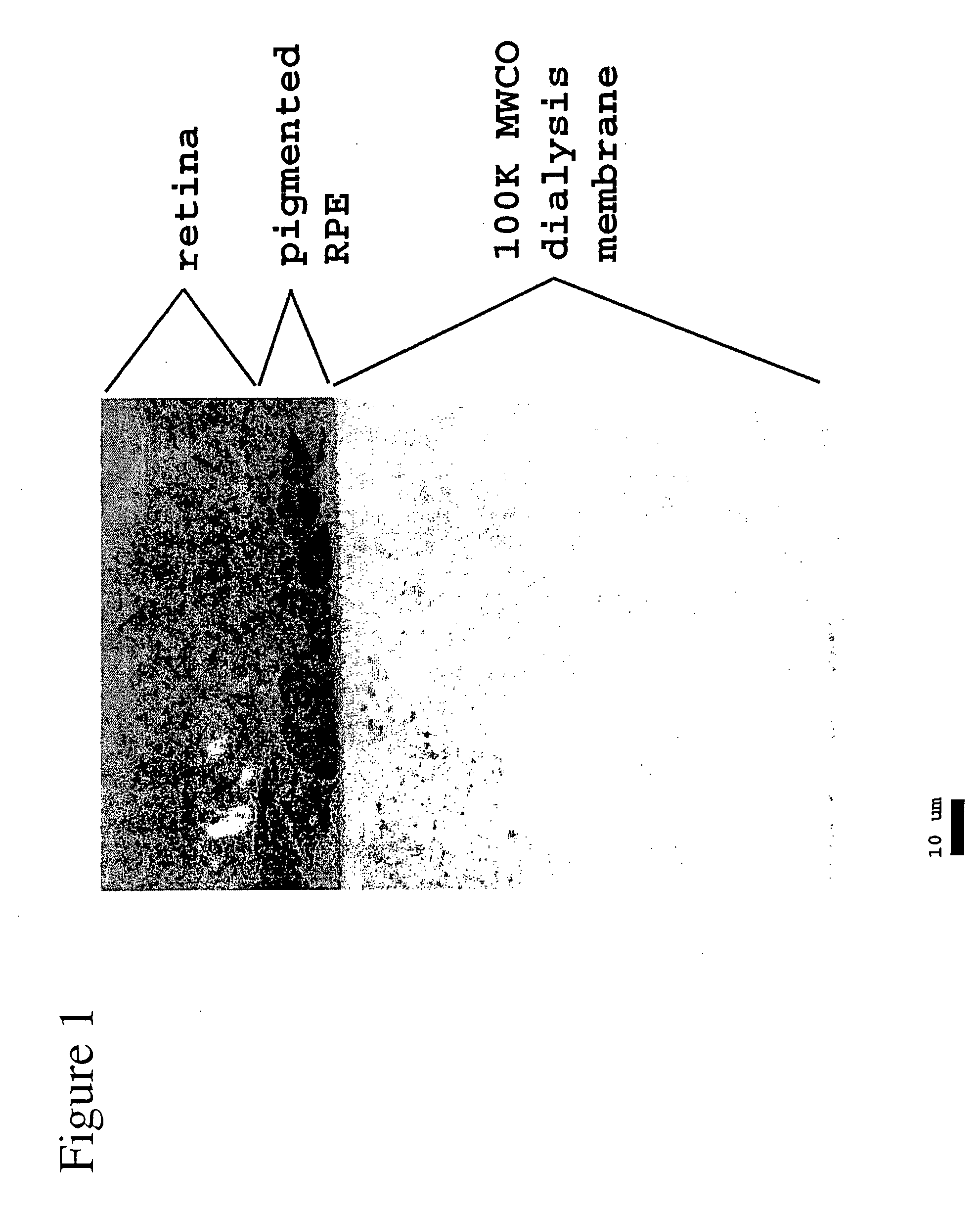 Artificial biocompatible material as a support for cells in a retinal implant