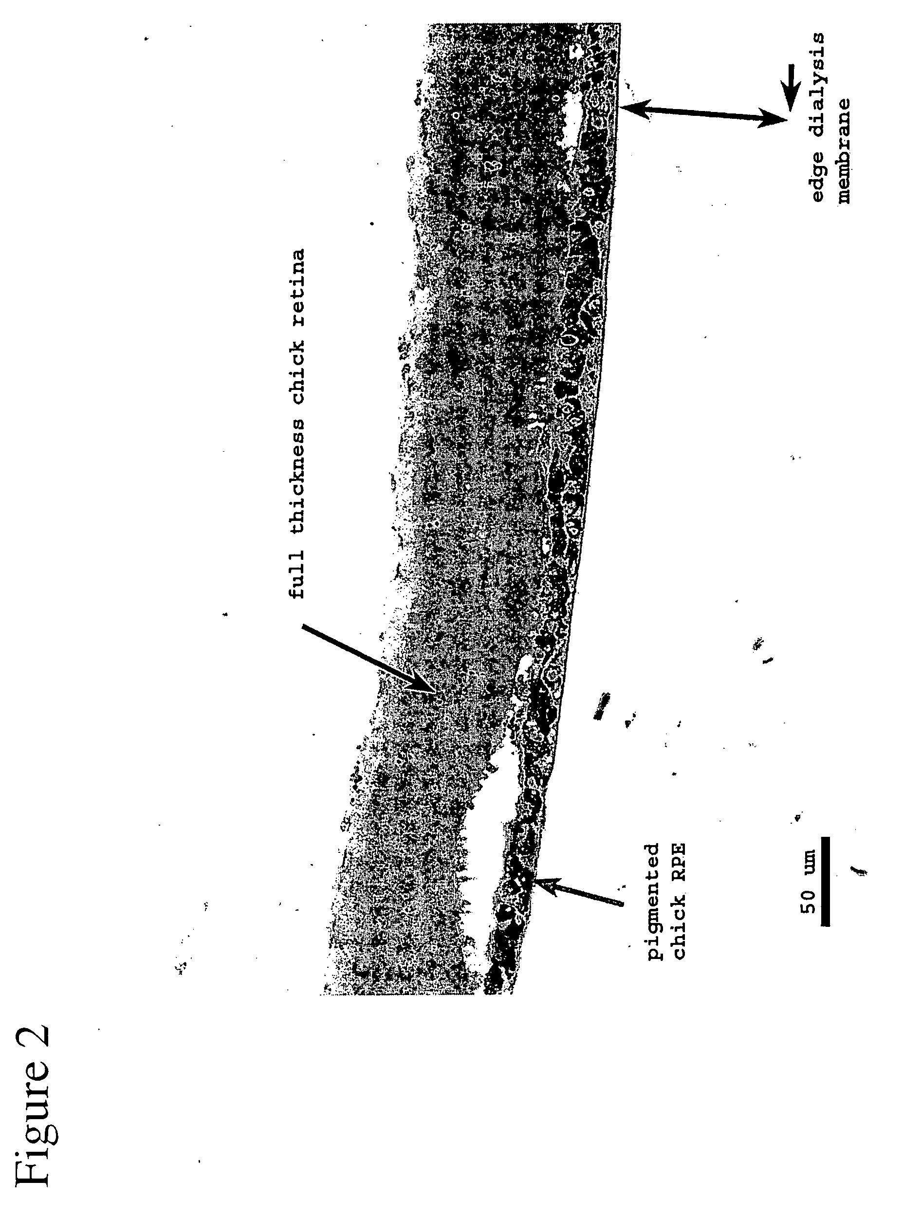 Artificial biocompatible material as a support for cells in a retinal implant