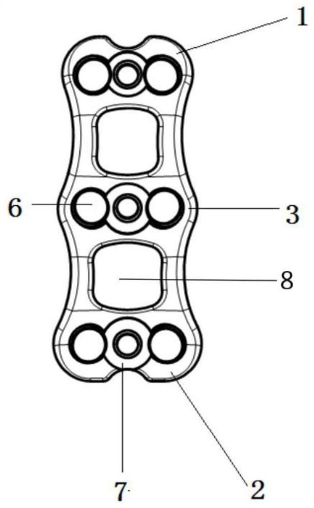 A special fixation device conforming to the anatomy and biomechanics of cervical and thoracic spine