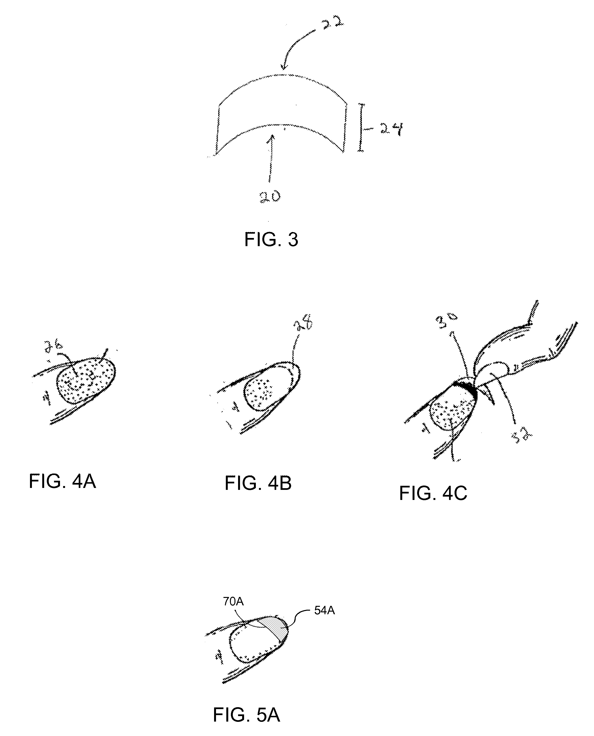 Method and product for attaining a french manicure using a dry nail appliqué