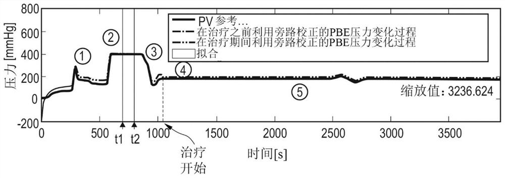 Pressure measurement in the extracorporeal blood circuit