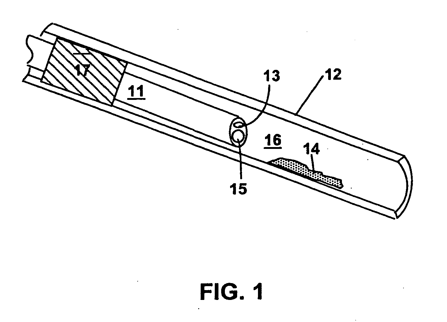 Methods and devices for reducing the mineral content of vascular calcified lesions