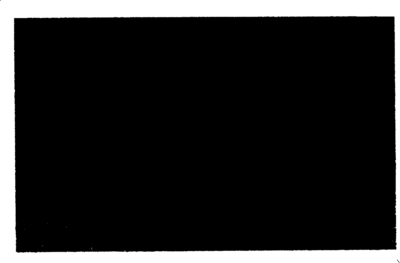 Microorganism polysaccharide and its preparation method and application