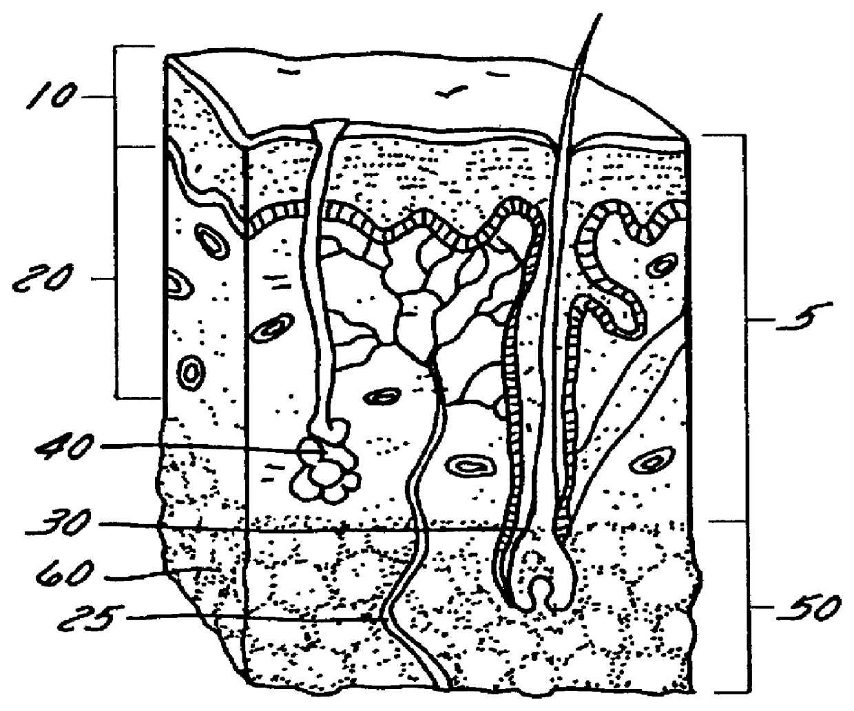 Accurate tissue injury assessment using hybrid neural network analysis