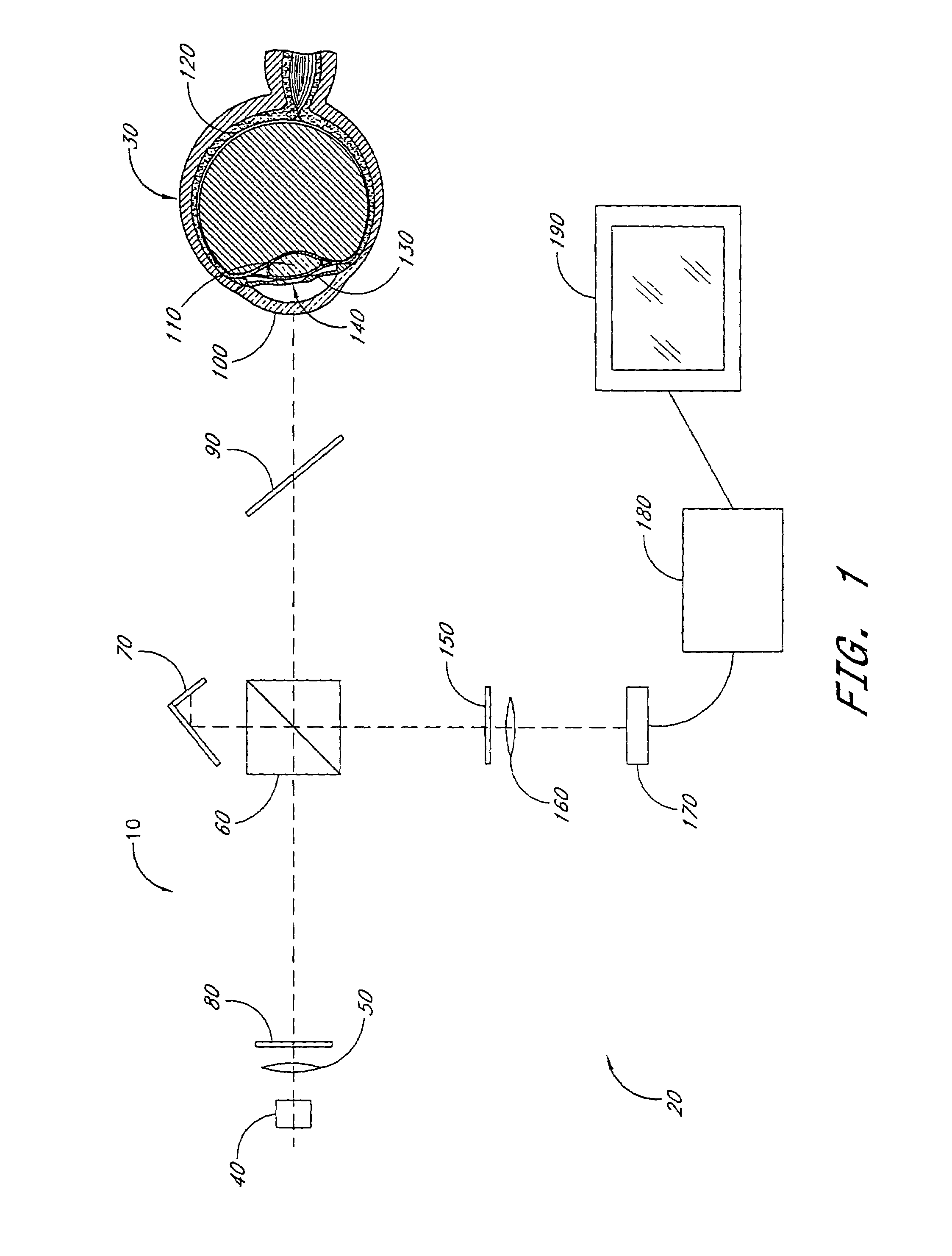 Cataract imaging apparatus