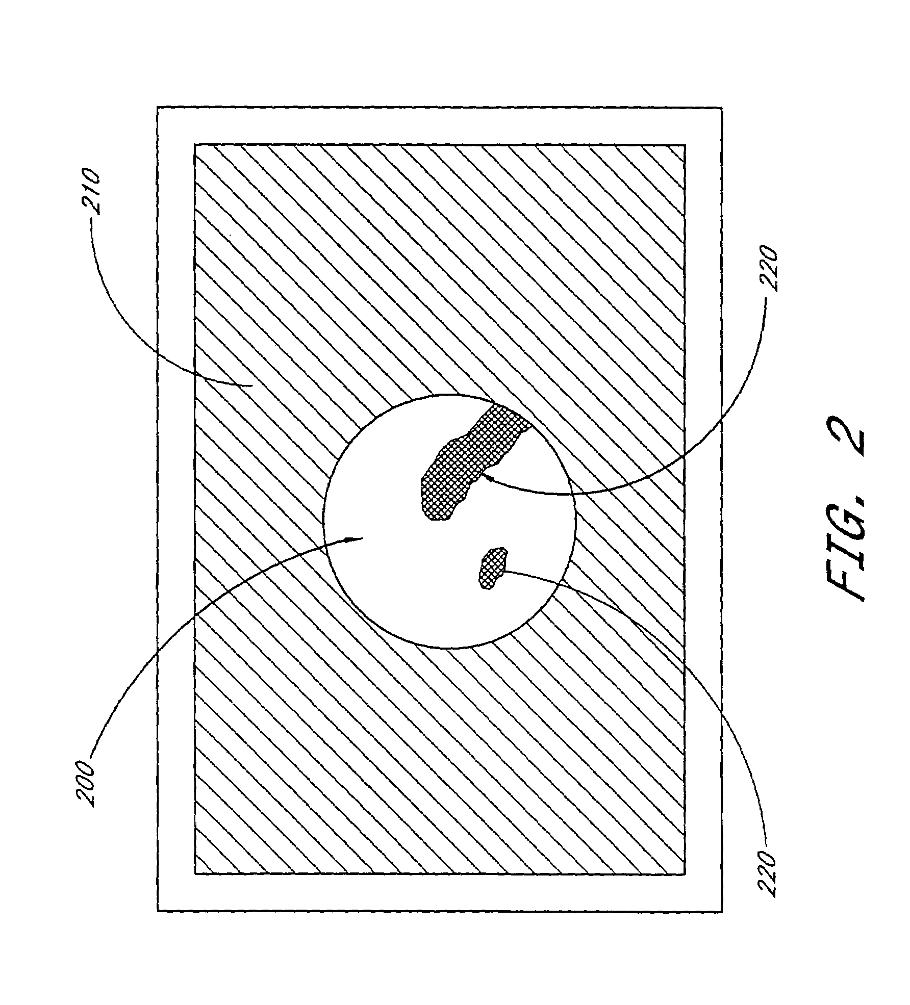 Cataract imaging apparatus