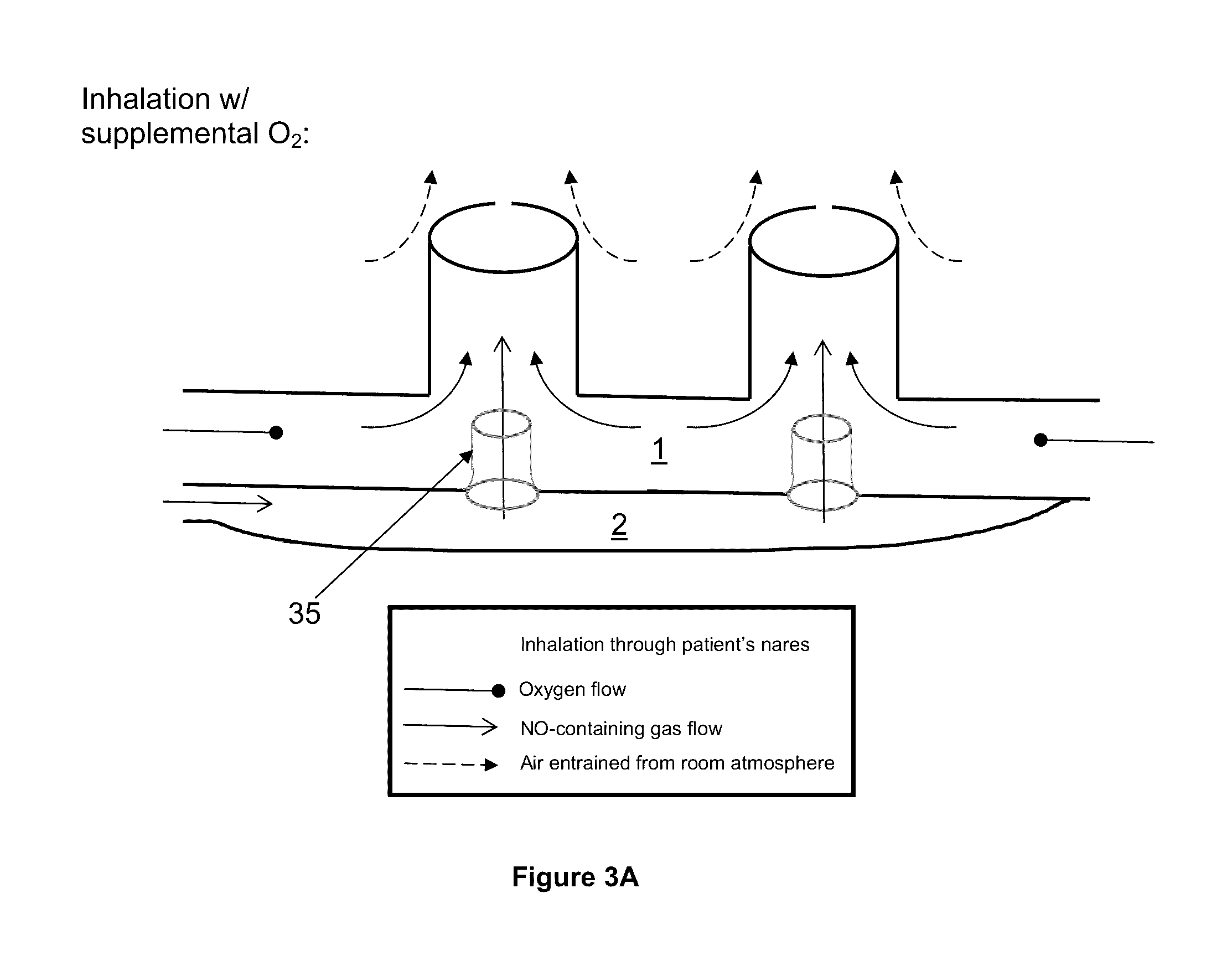 Breathing assistance apparatus for delivery of nitric oxide to a patient by means of a nasal cannula assembly with flow control passage