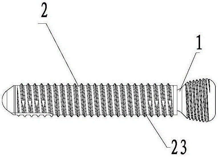 Elastic bone screw