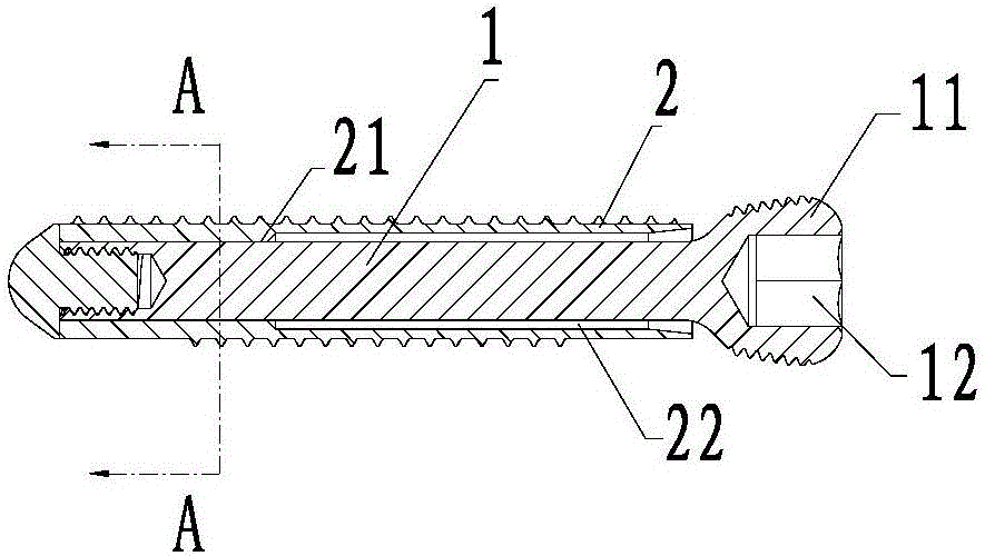 Elastic bone screw