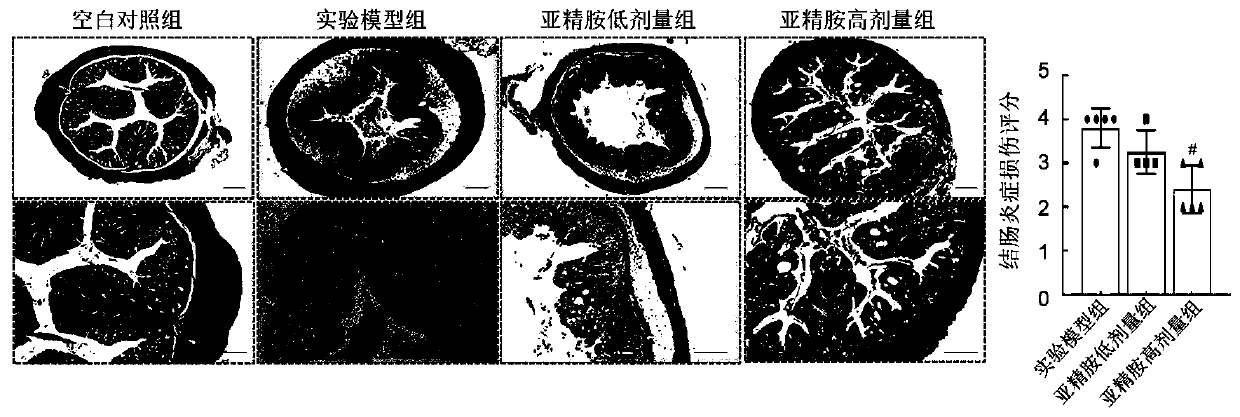 Application of spermidine in preparation of medicines for treating colitis