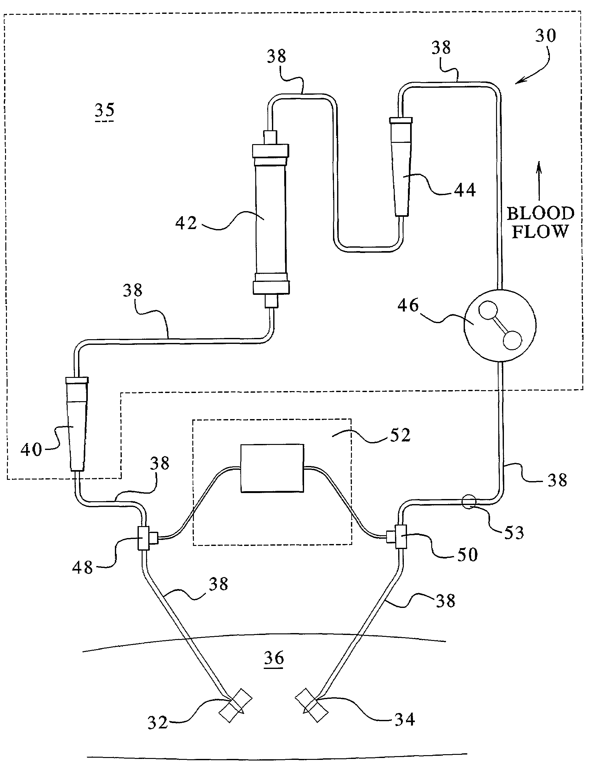 Access disconnection systems and methods