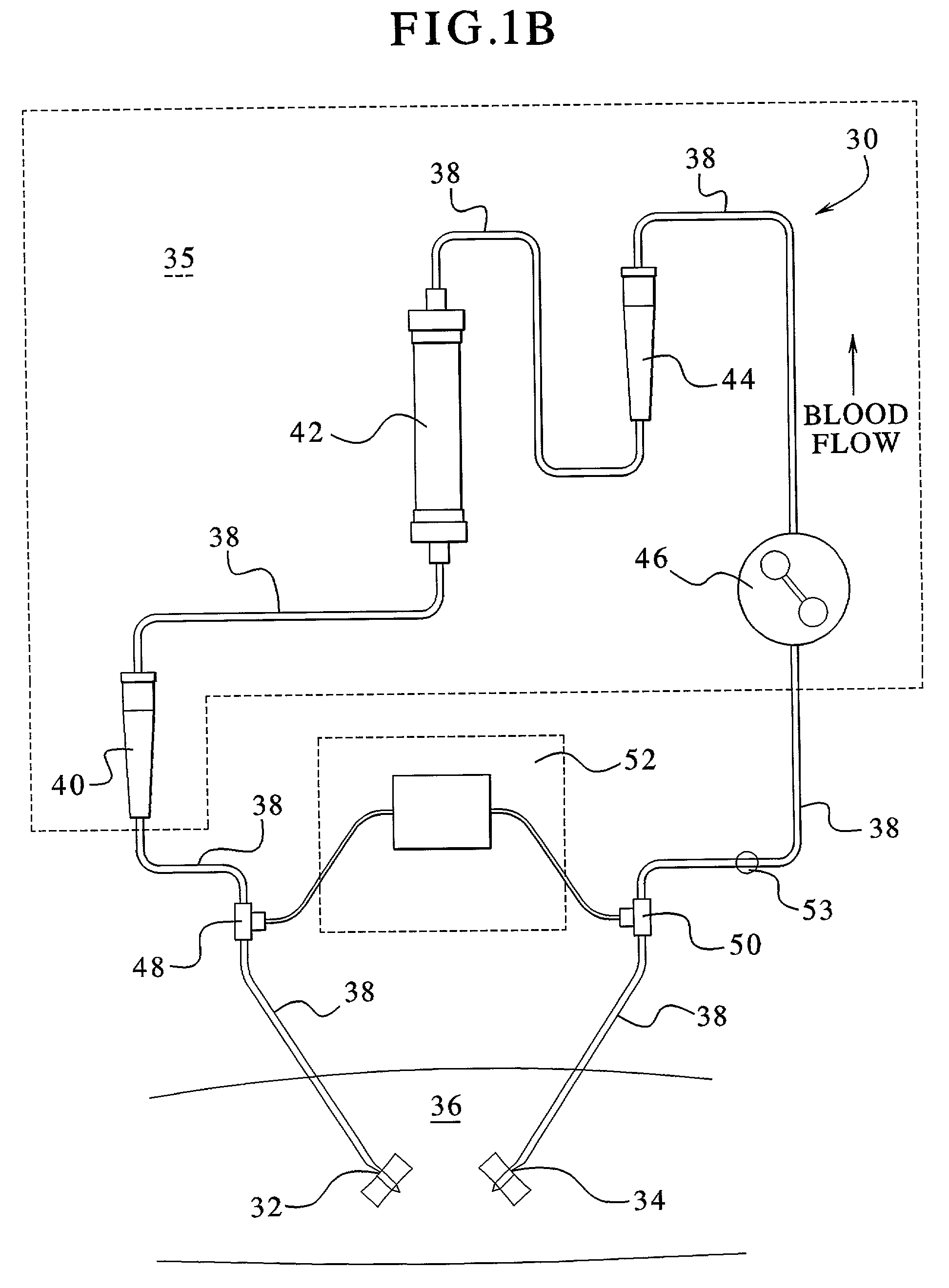 Access disconnection systems and methods