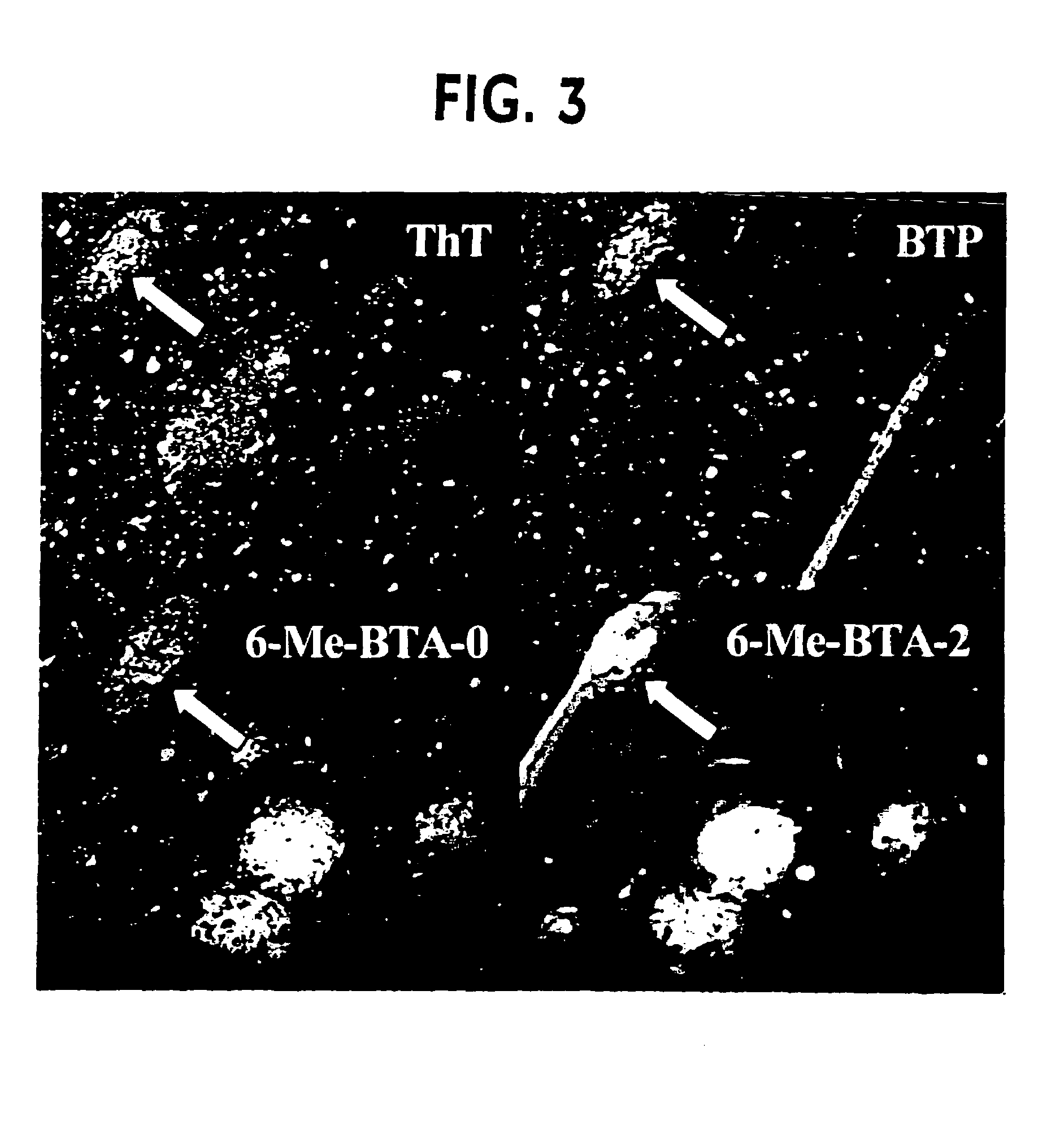 Thioflavin derivatives for use in the antemortem diagnosis of Alzheimers disease and in vivo imaging and prevention of amyloid deposition