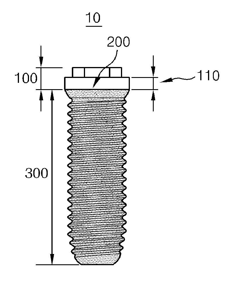 Dental Implant Fixture