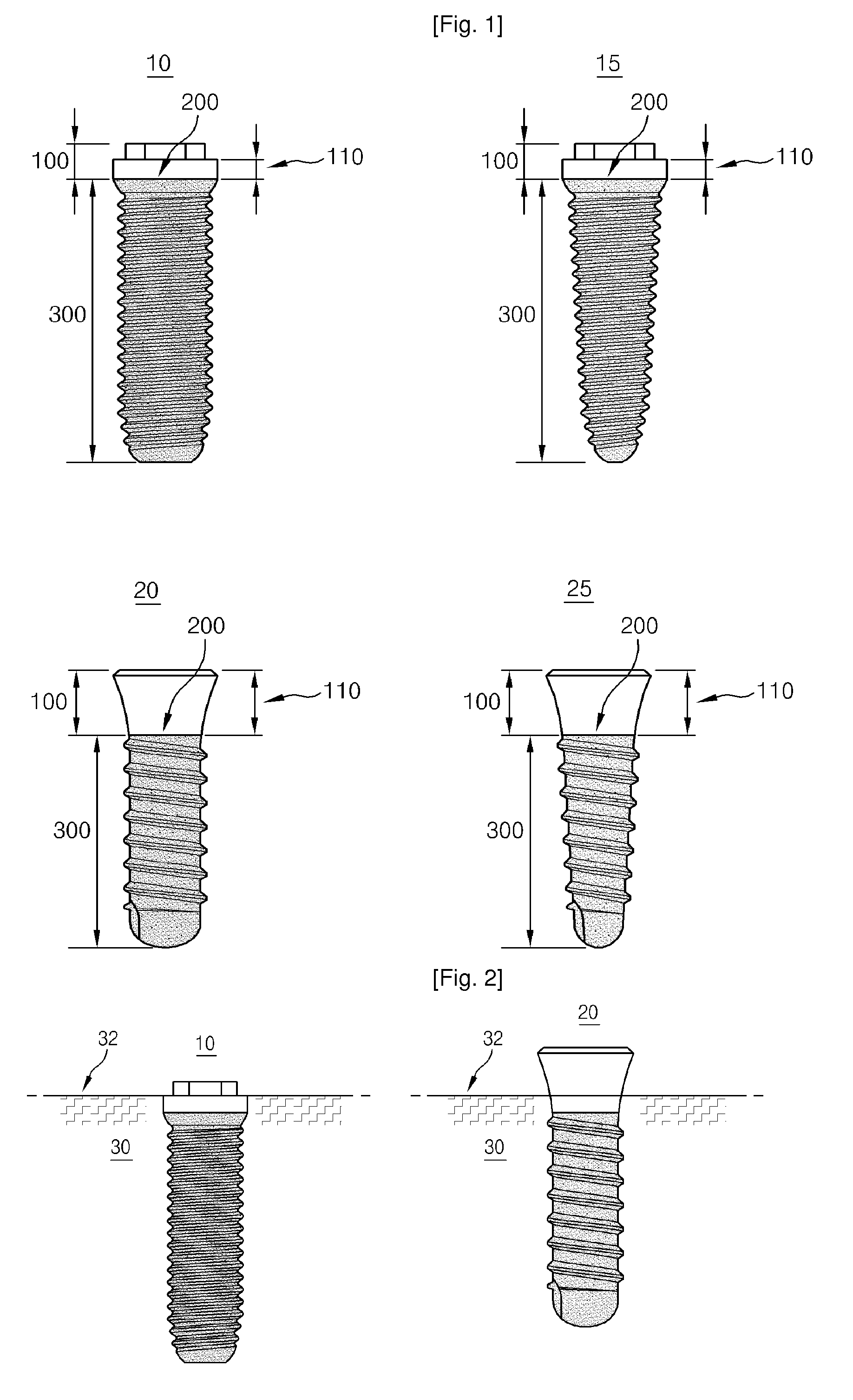 Dental Implant Fixture