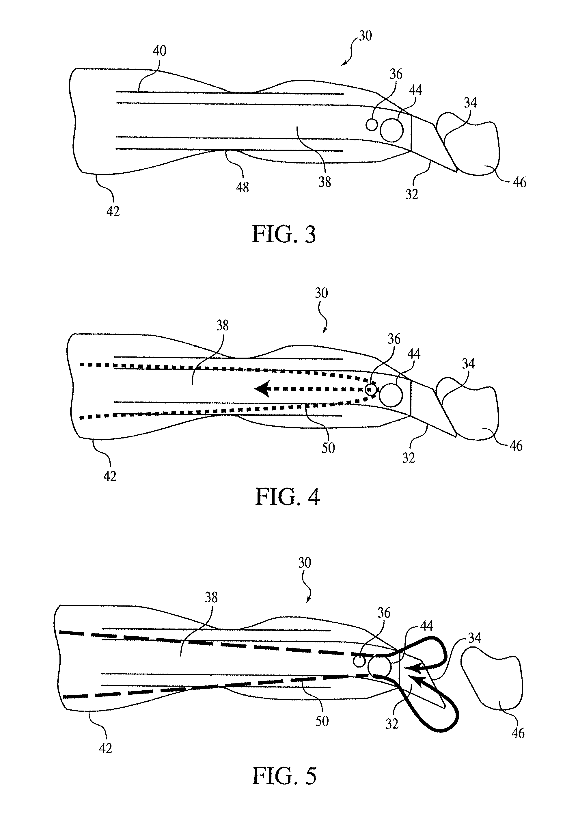 Torsional Ultrasound Hand Piece That Eliminates Chatter