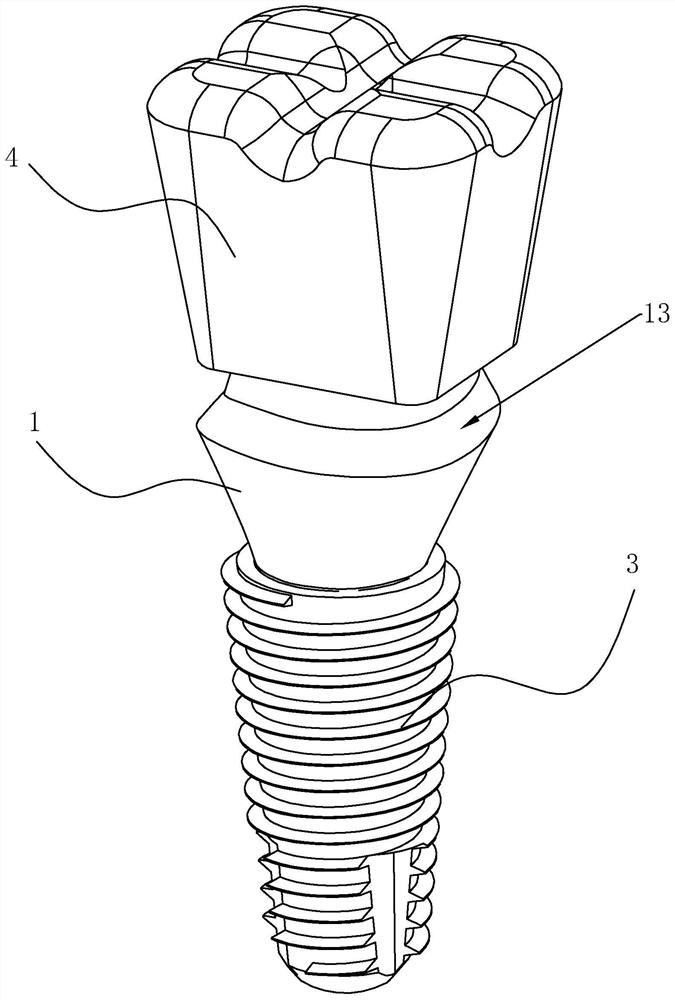 Personalized transfer composite abutment