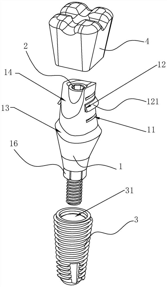 Personalized transfer composite abutment