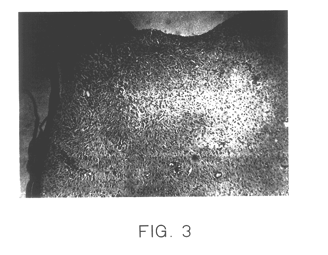 Non-viable keratinocyte cell composition or lysate for promoting wound healing