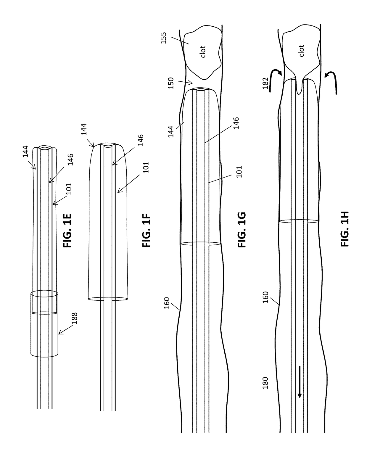 Pre-loaded inverting tractor thrombectomy apparatuses and methods