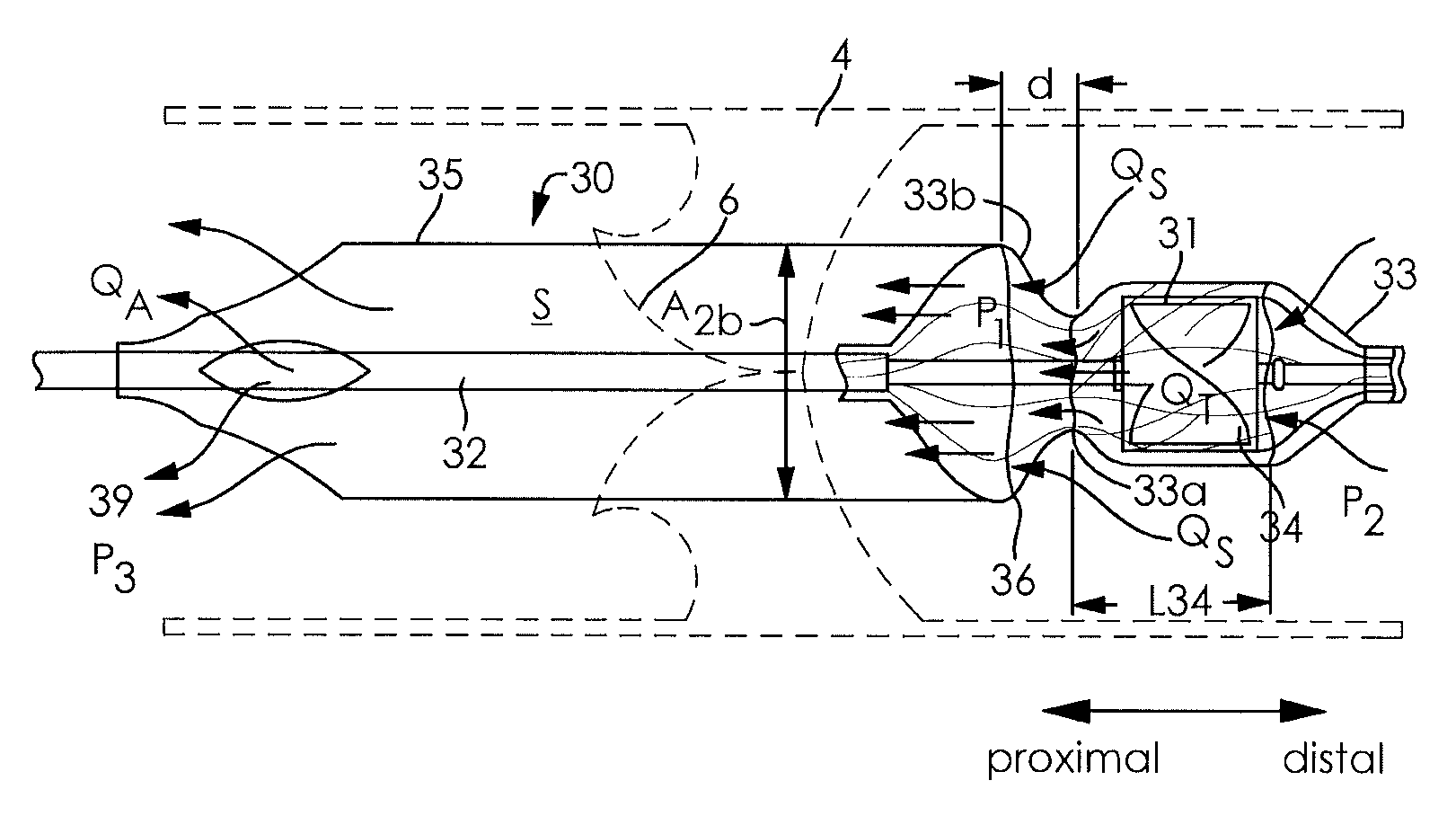 Pump arrangement