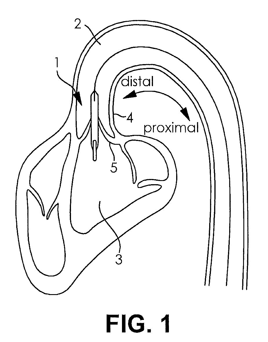 Pump arrangement