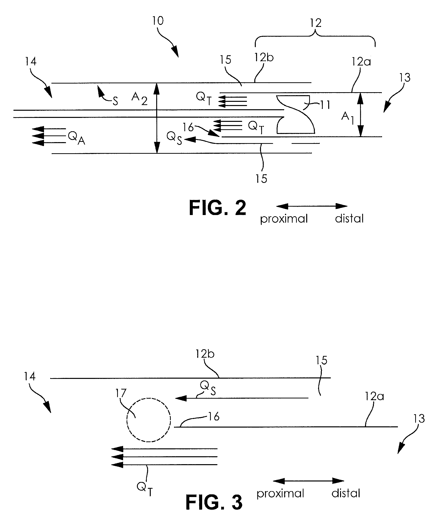 Pump arrangement