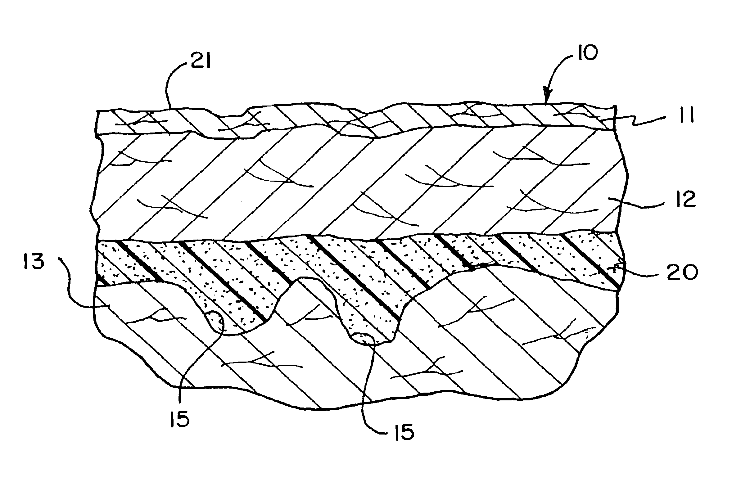 Soft tissue substitute and method of soft tissue reformation