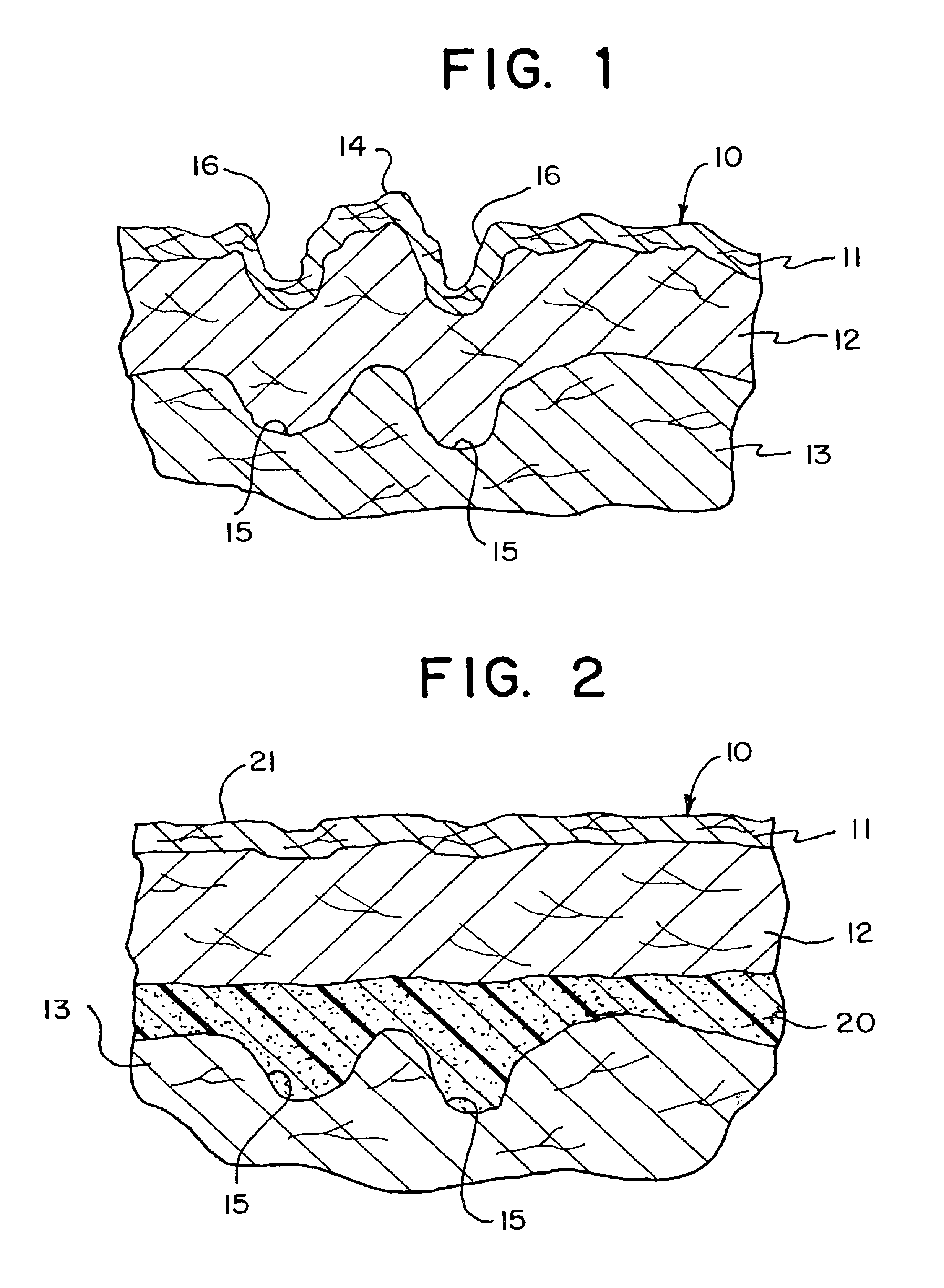 Soft tissue substitute and method of soft tissue reformation