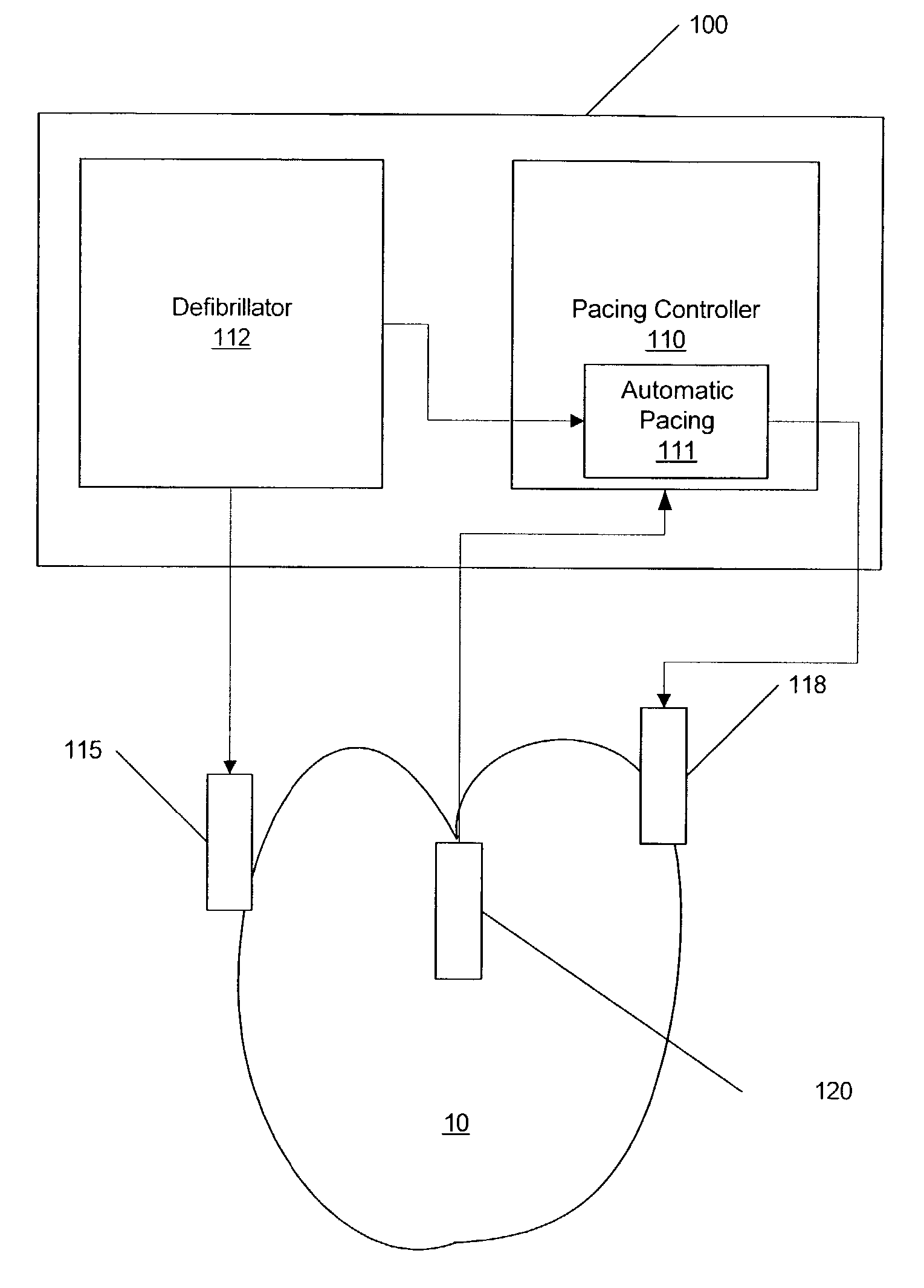 Post-defibrillation pacing methods and devices