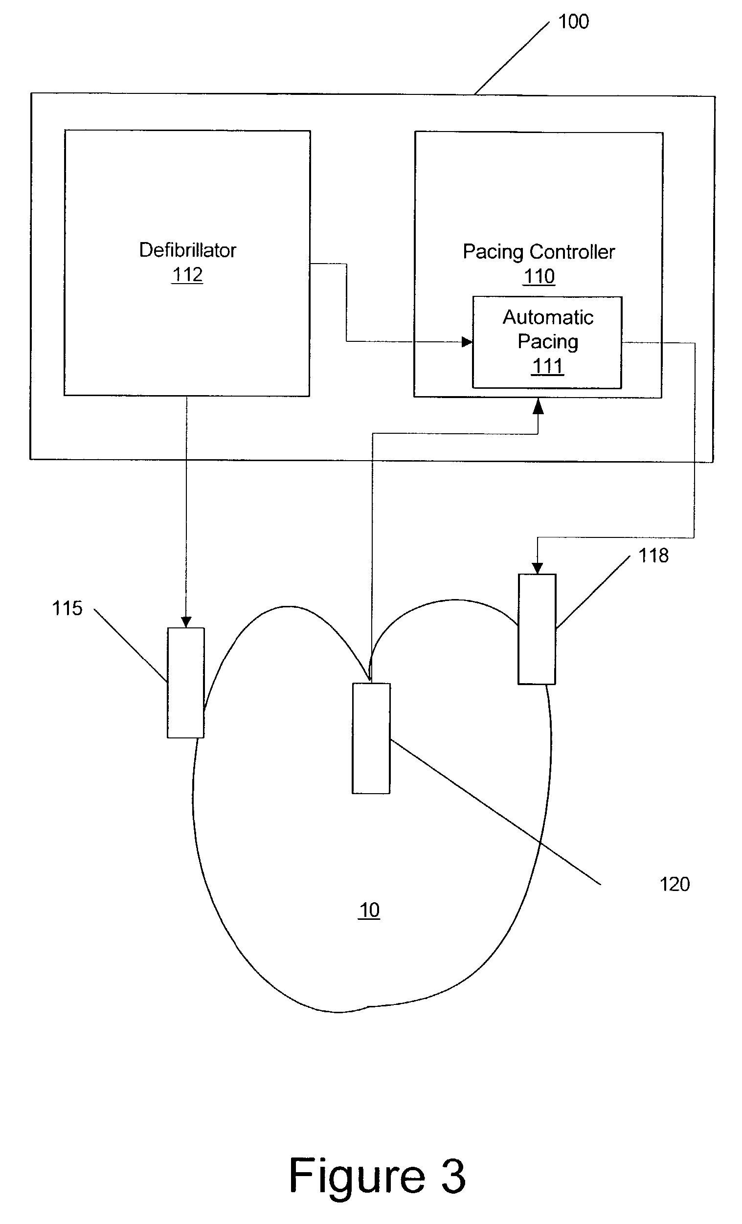 Post-defibrillation pacing methods and devices