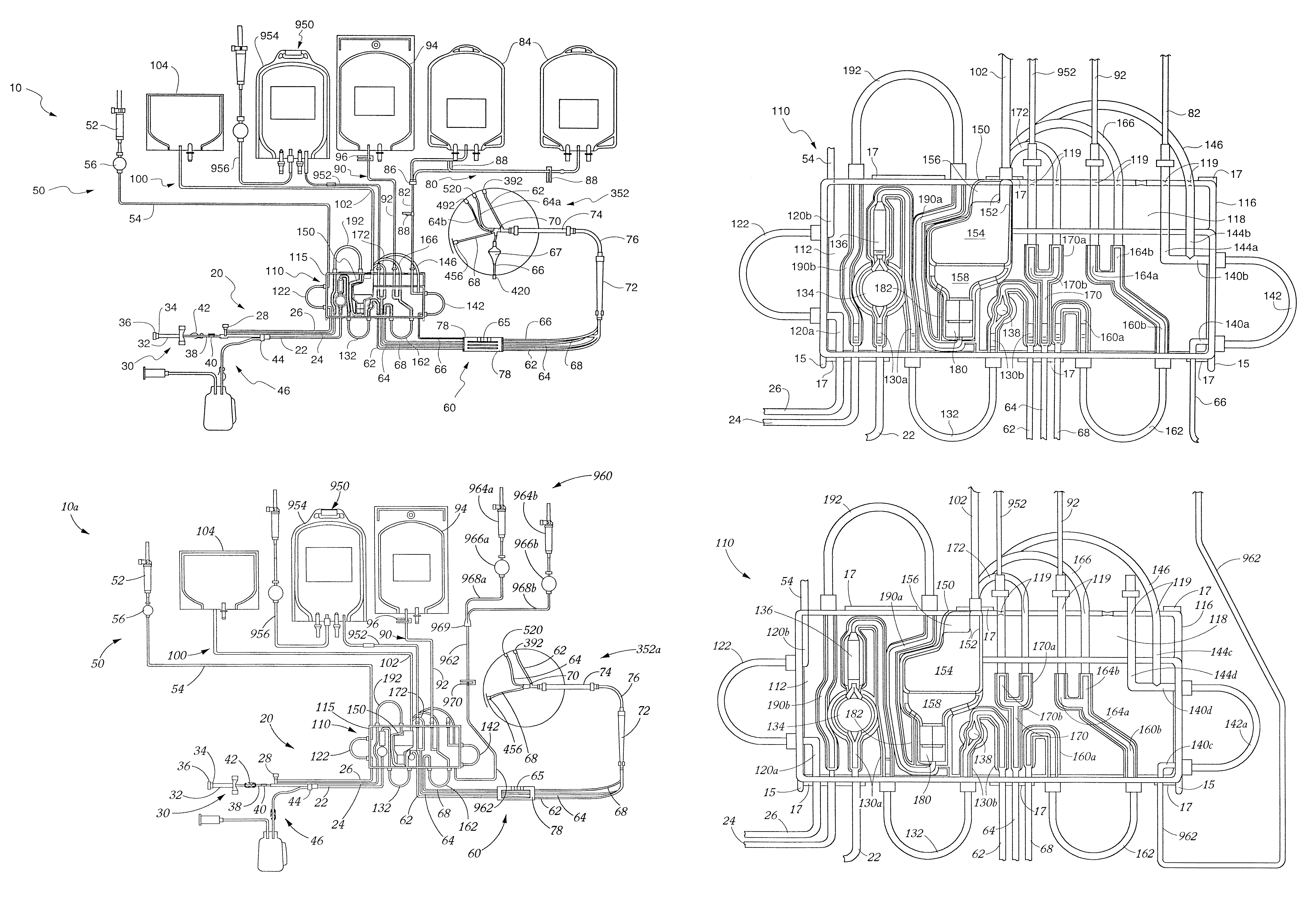 Extra-corporeal blood processing method and apparatus based on donor characteristics