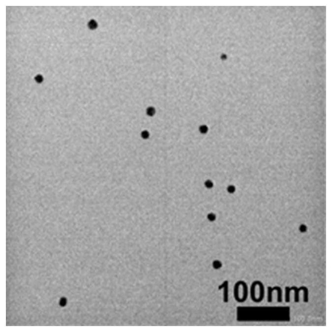 Preparation method and application of bionic nano-carrier for reducing excessive calcium ions in tumors