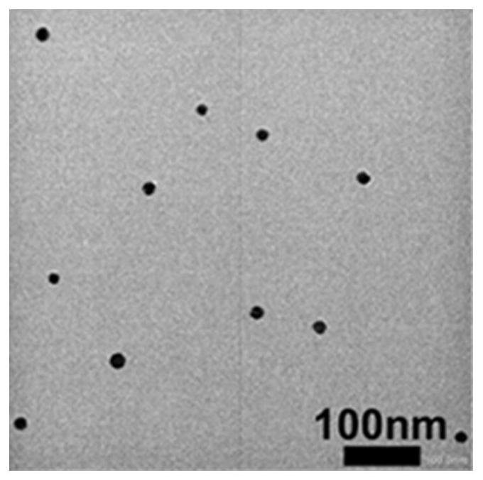 Preparation method and application of bionic nano-carrier for reducing excessive calcium ions in tumors