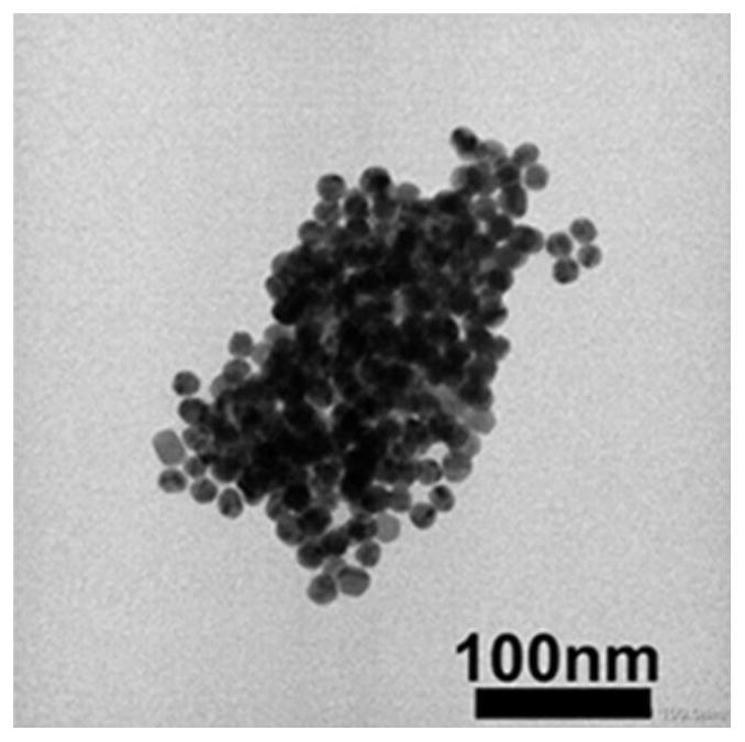 Preparation method and application of bionic nano-carrier for reducing excessive calcium ions in tumors