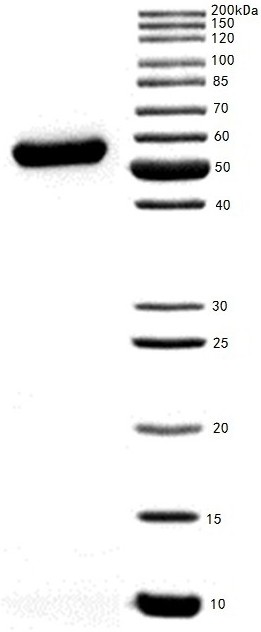 Anti-human msln monoclonal antibody and its application