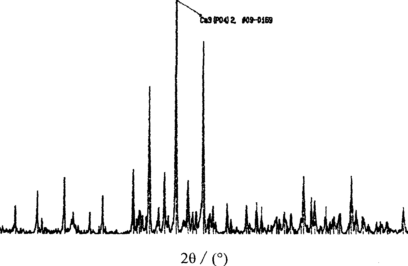 Preparation of powder of beta-TCP bioceramic possessing crystal grain structure of laminar clearage