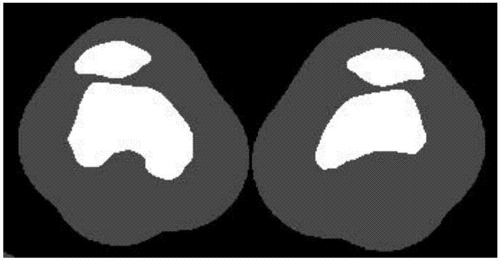 Knee osteoarthritis course detection method based on near-infrared light