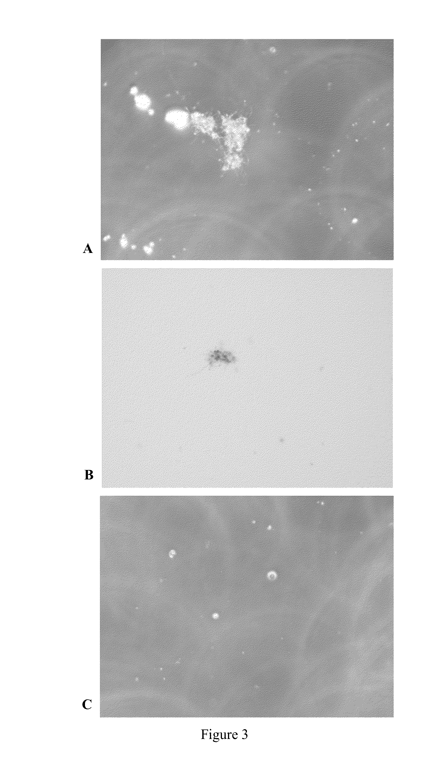 Compositions and methods for culturing spirochetes