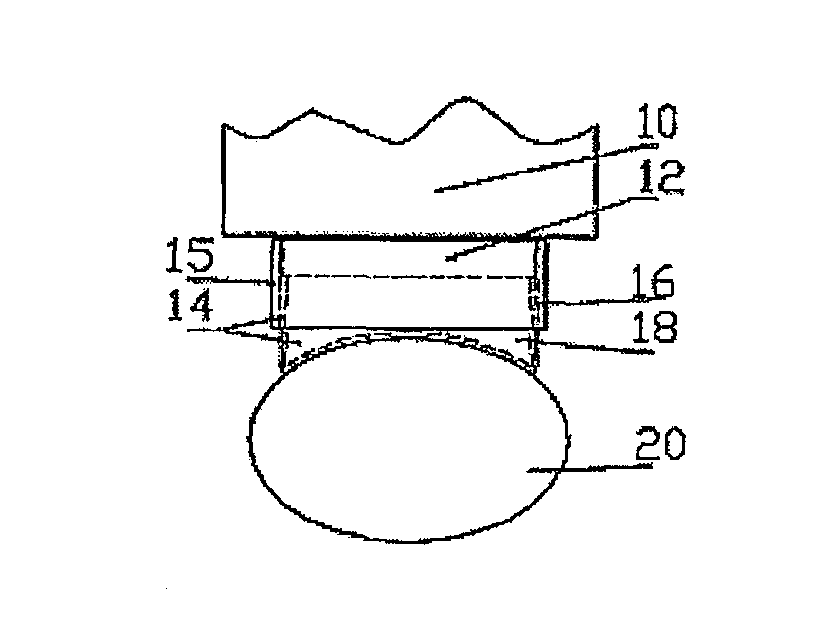 Light guide for coupling light output from a light source to the skin