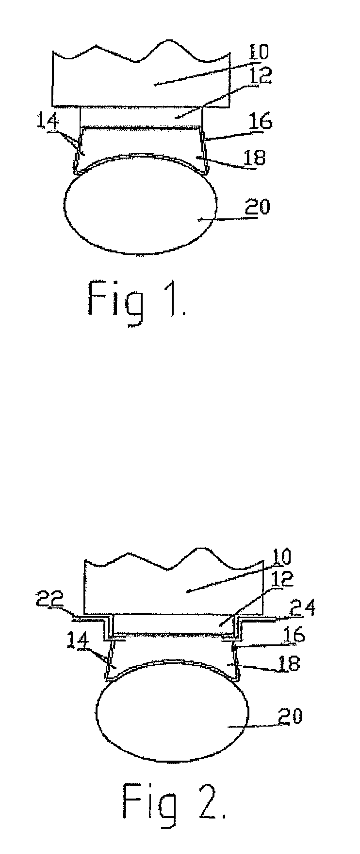 Light guide for coupling light output from a light source to the skin