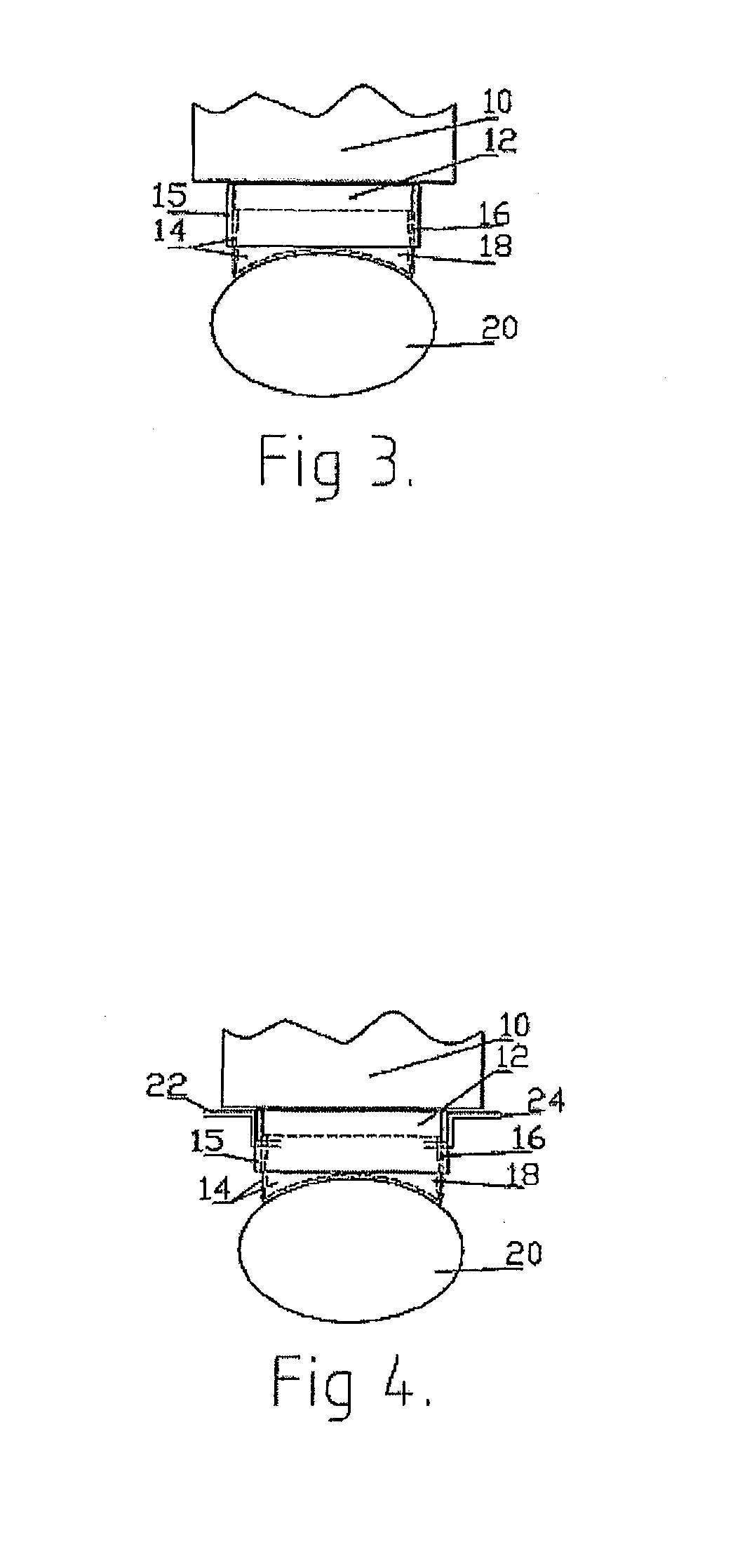 Light guide for coupling light output from a light source to the skin